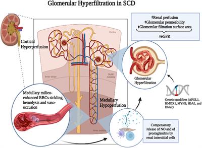 Glomerular filtration rate abnormalities in sickle cell disease